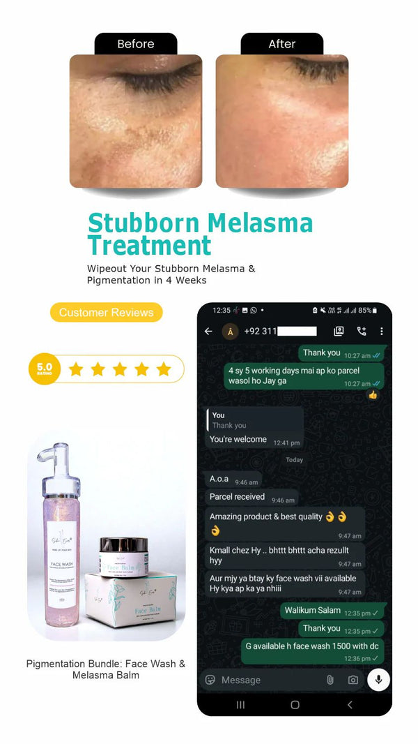 Face Balm For Melasma